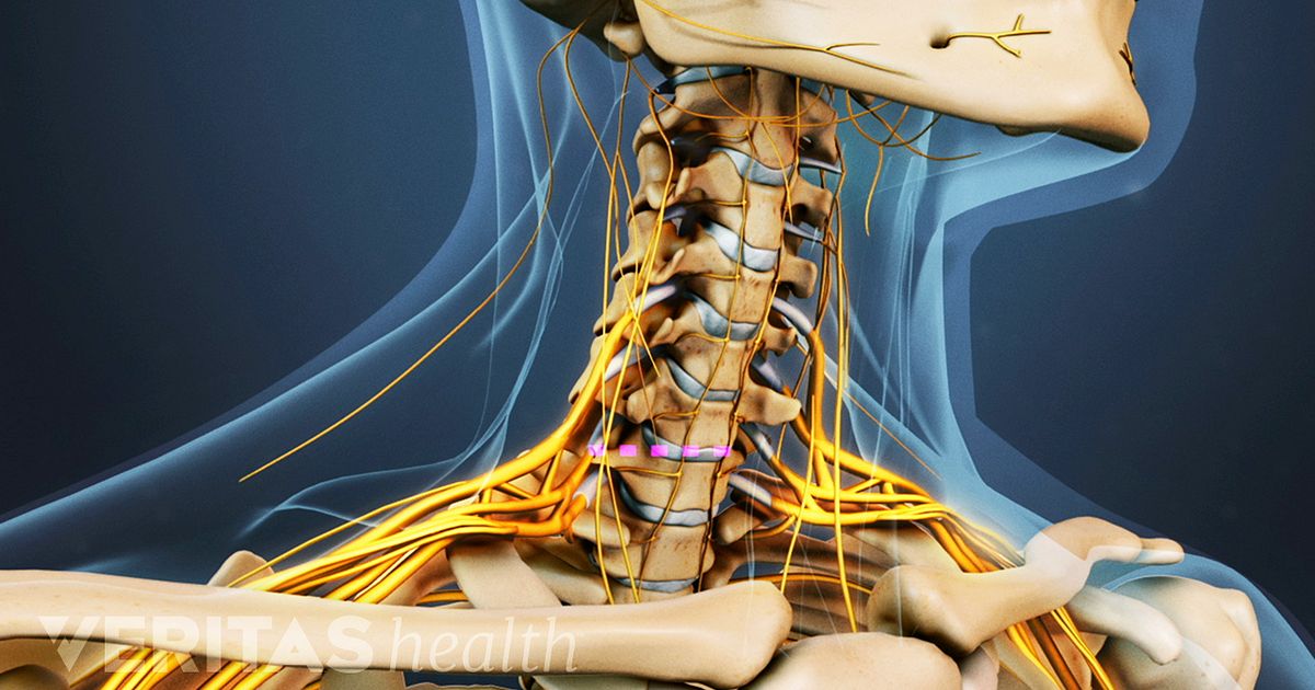 Pilates & Spine Pathologies Workshop